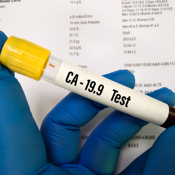 CA - 19.9 Pancreatic Cancer