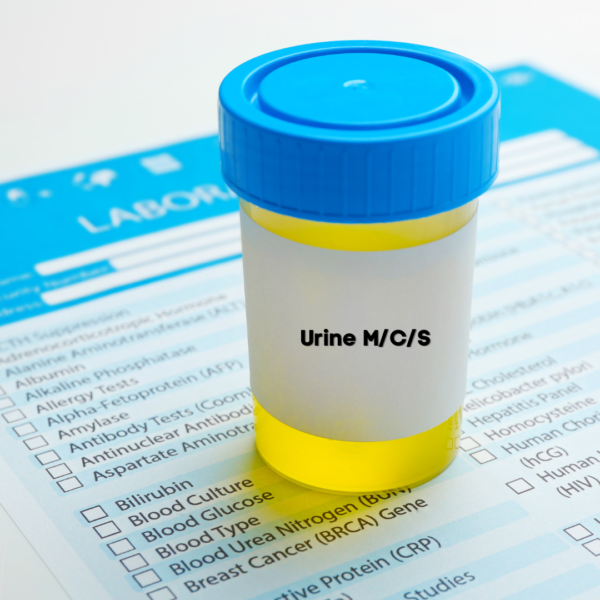Urine M/C/S