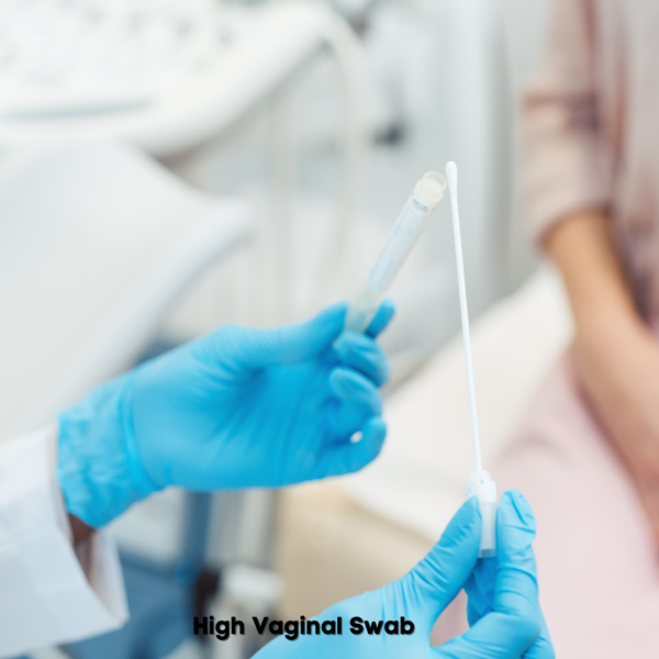High Vaginal Swab