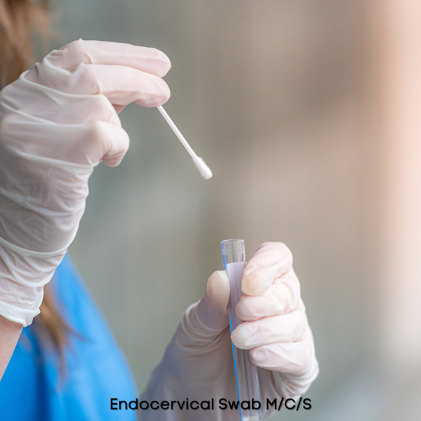 Endocervical Swab M/C/S
