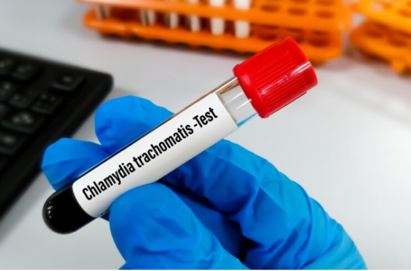 Chlamydia