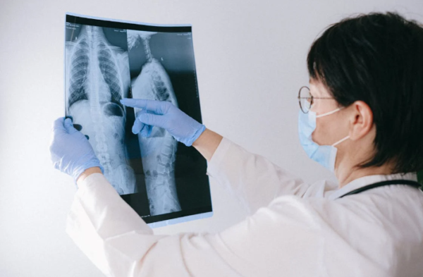 Cervical Spine X- Ray (AP/LAT)