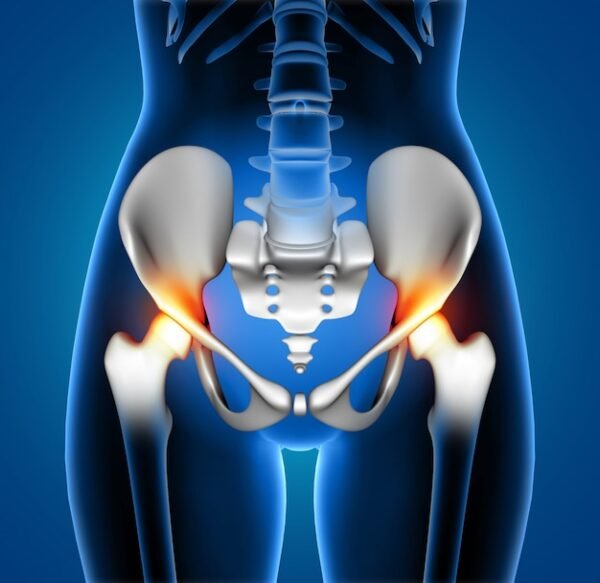 Pelvic X- Ray