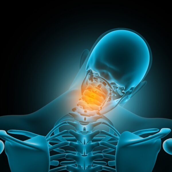 Neck (Soft Tissue)