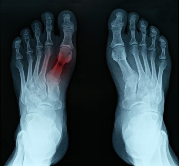 Feet Both