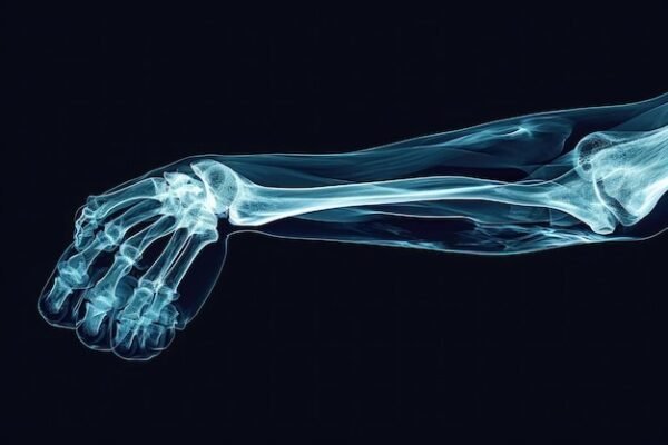 Forearm Single (AP/LAT)