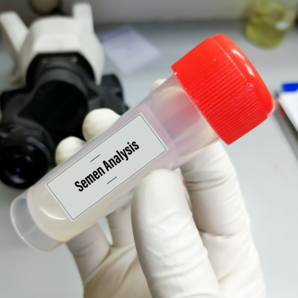 Semen Analysis