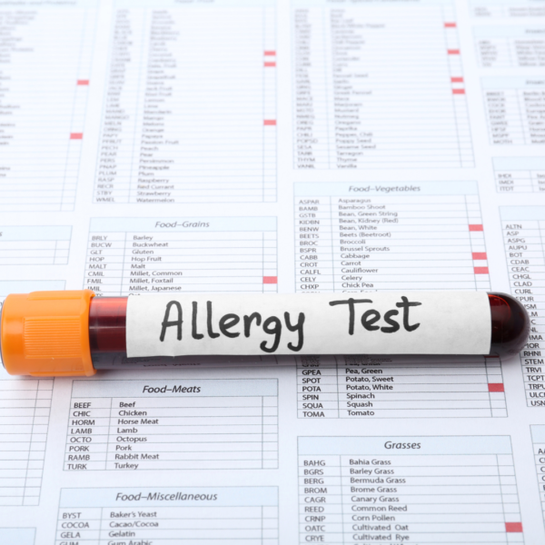 Allergy Test (For 20 Food Allergies)